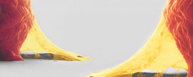 In Vivo Implantation